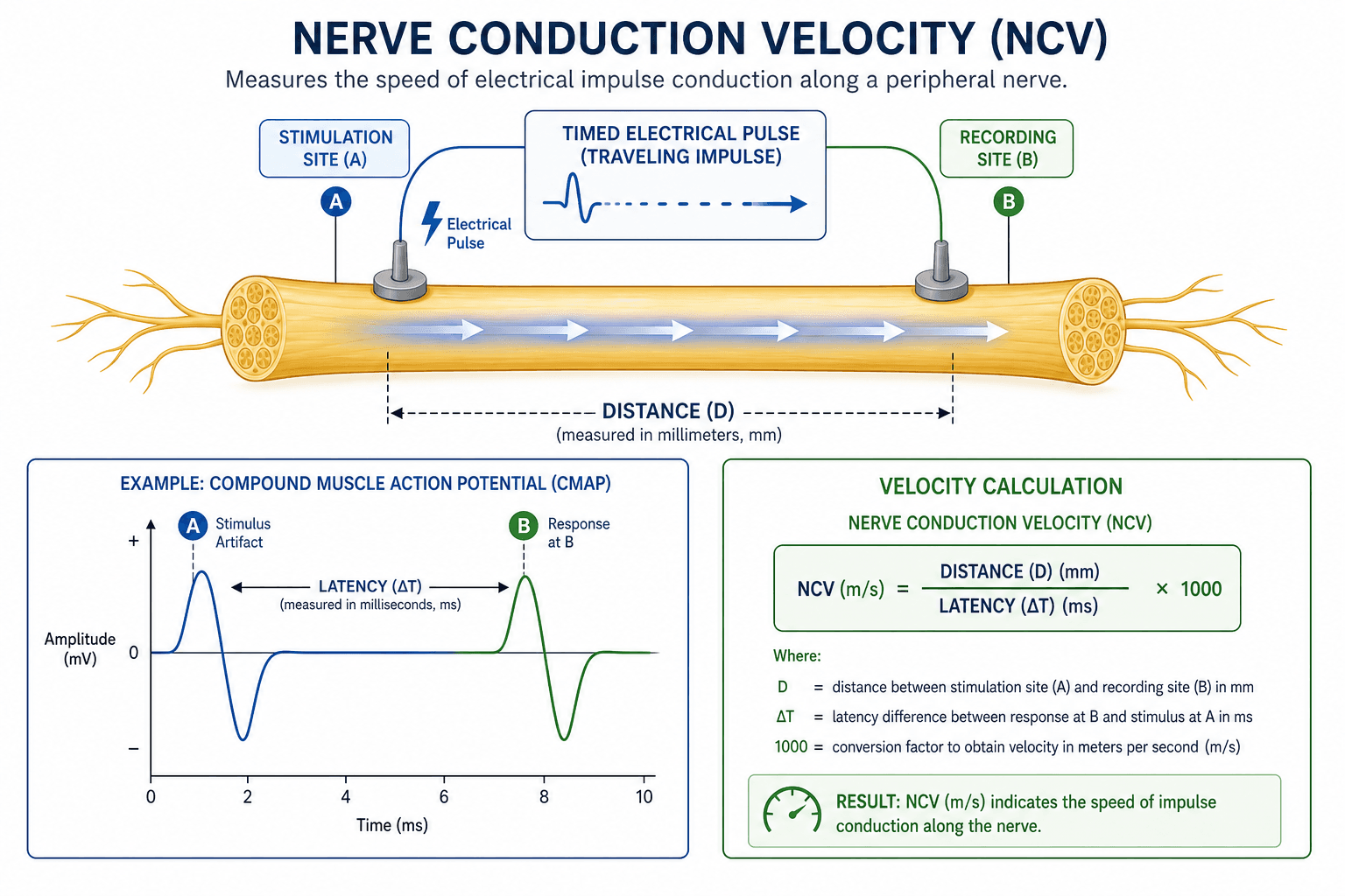 Illustration of NCV testing measuring electrical activity along the peripheral nervous system